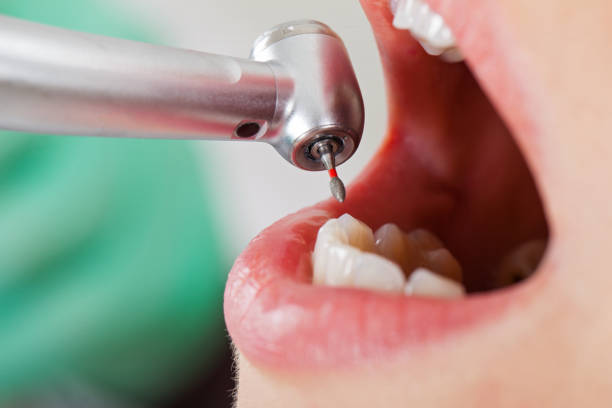 Best Urgent Care for Lost Fillings or Crowns in Wayne, OH